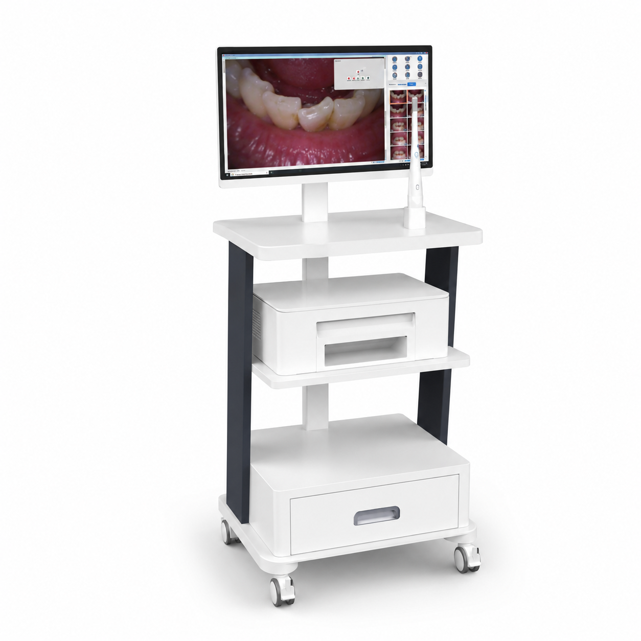 AI Intraoral Camera
