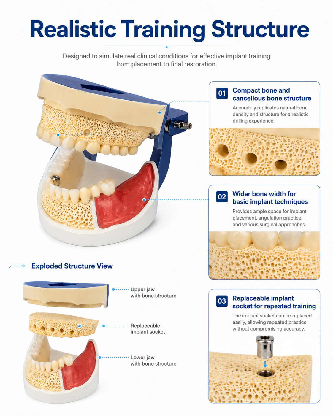 Implant Practice Model detail 2