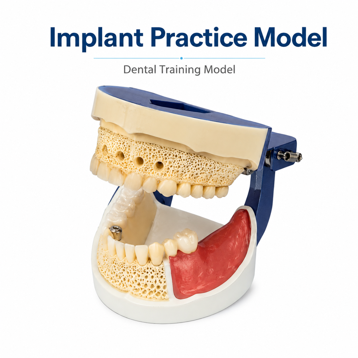Implant Practice Model