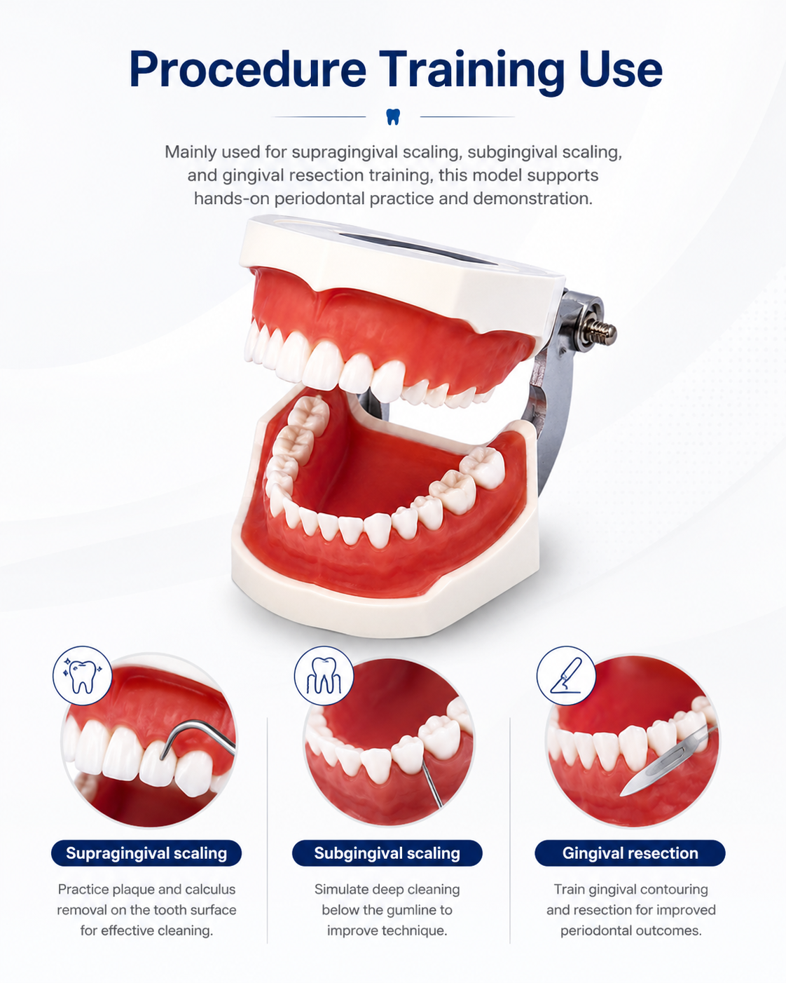 Periodontal Disease Model detail 3