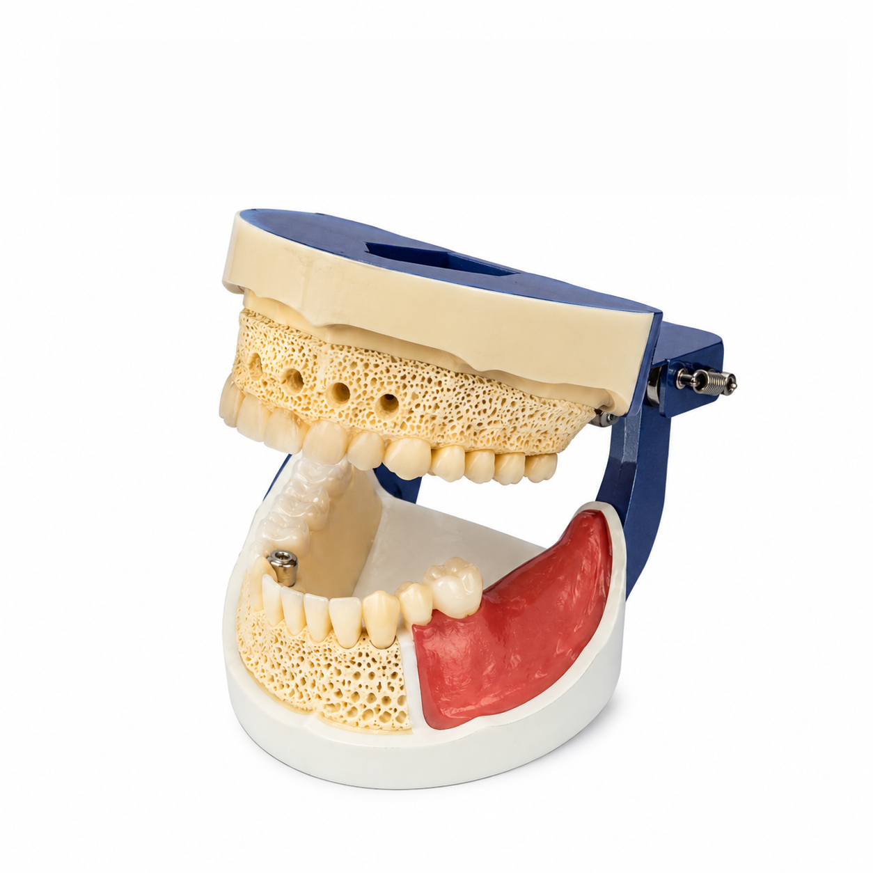 Implant Practice Model